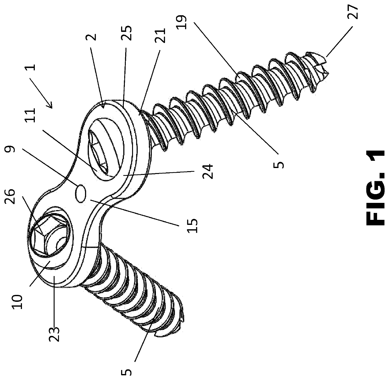 Internal plate fixation device