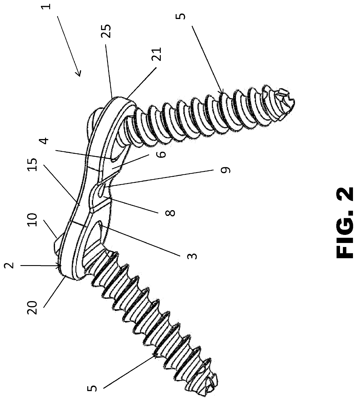 Internal plate fixation device