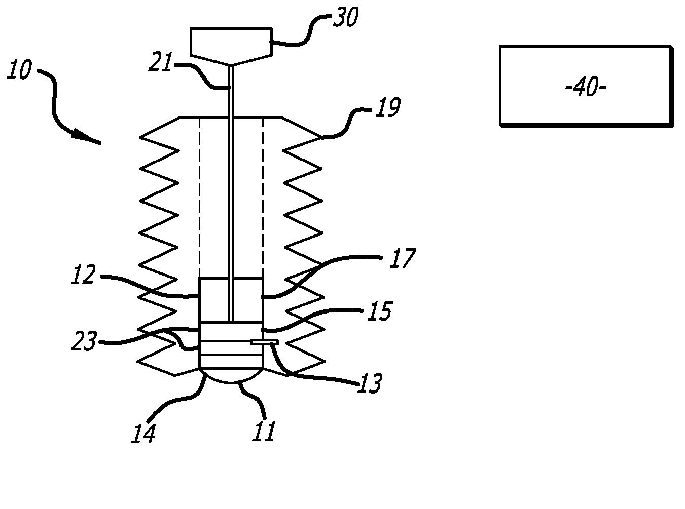 Acoustic Back-Scattering Sensing Screw for Preventing Spine Surgery Complications