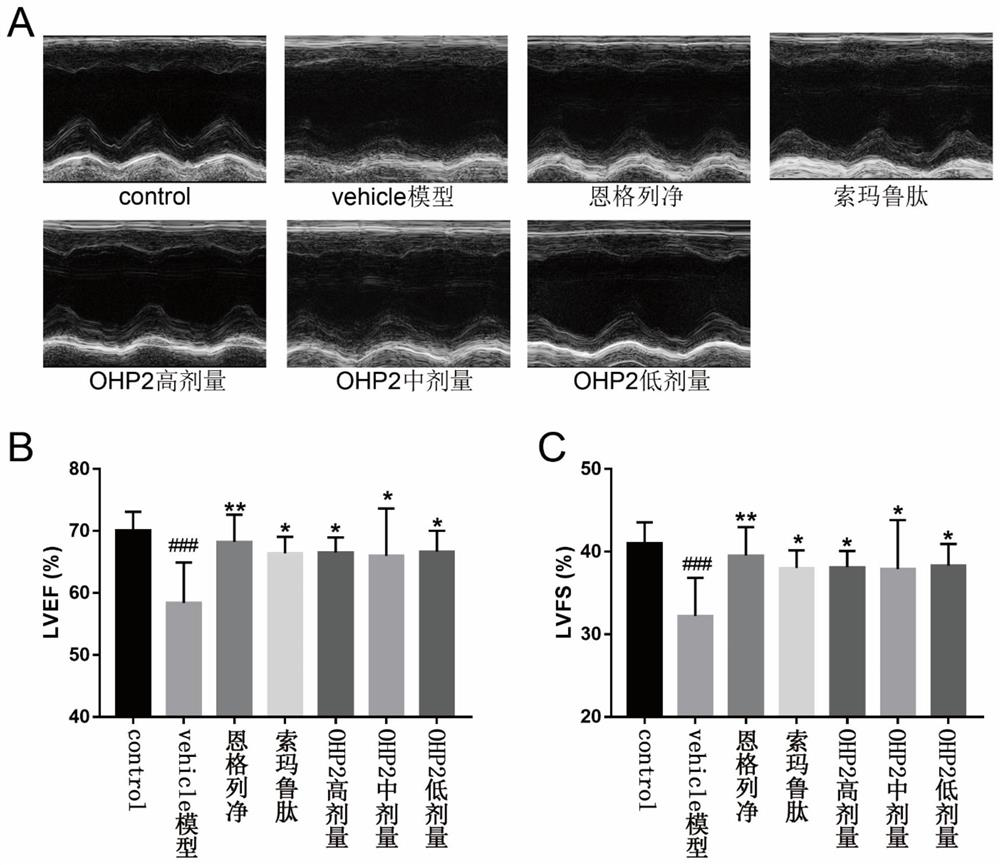 Application of an oral hypoglycemic peptide in the preparation of drugs for treating or preventing diabetes complicated with cardiovascular disease