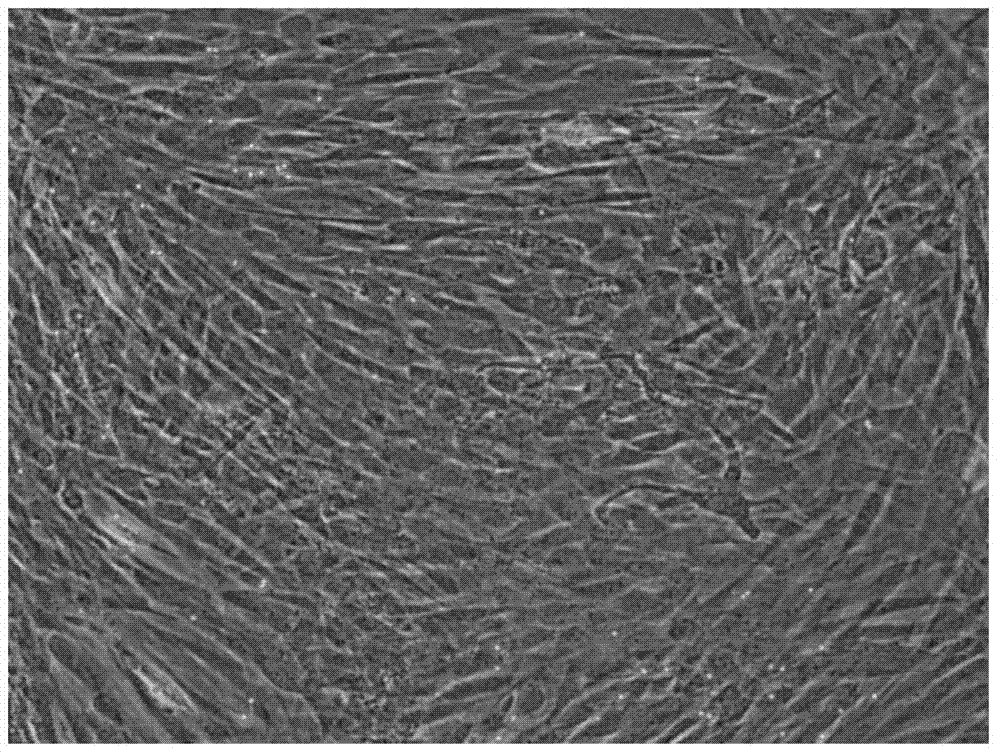 Serum-free medium for culturing placenta mesenchymal stem cells