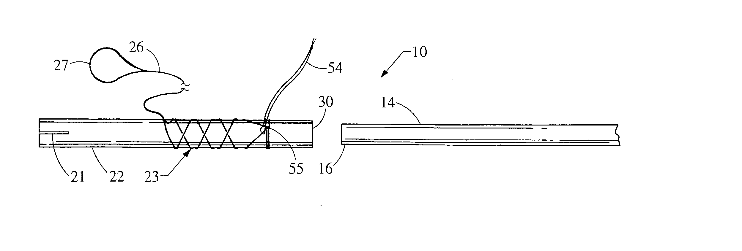 Device for removing an elongated structure implanted in biological tissue