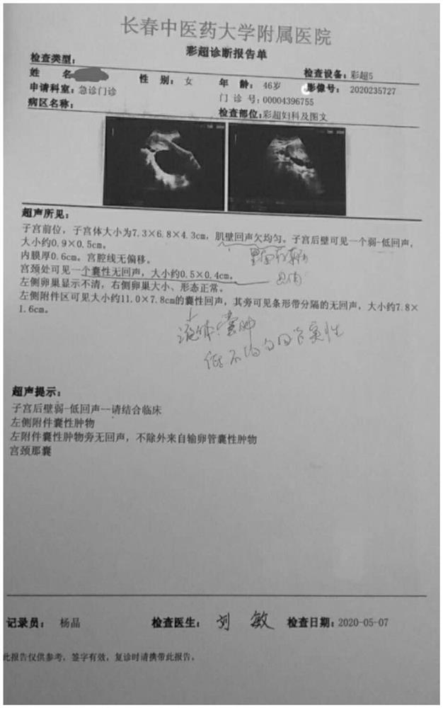 Tumor eliminating and muscle shrinking suppository and preparation method and application thereof