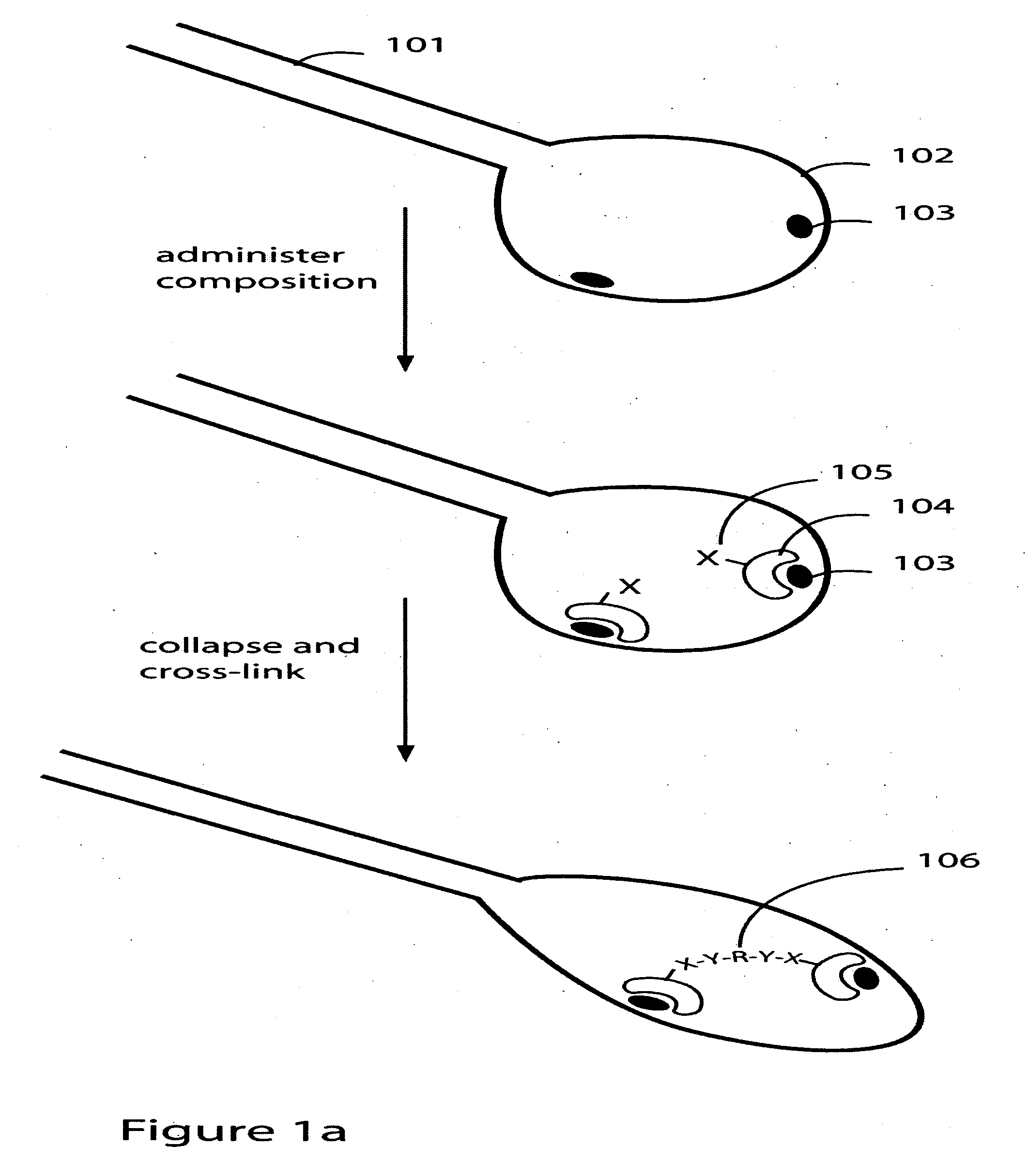 Imaging damaged lung tissue using compositions