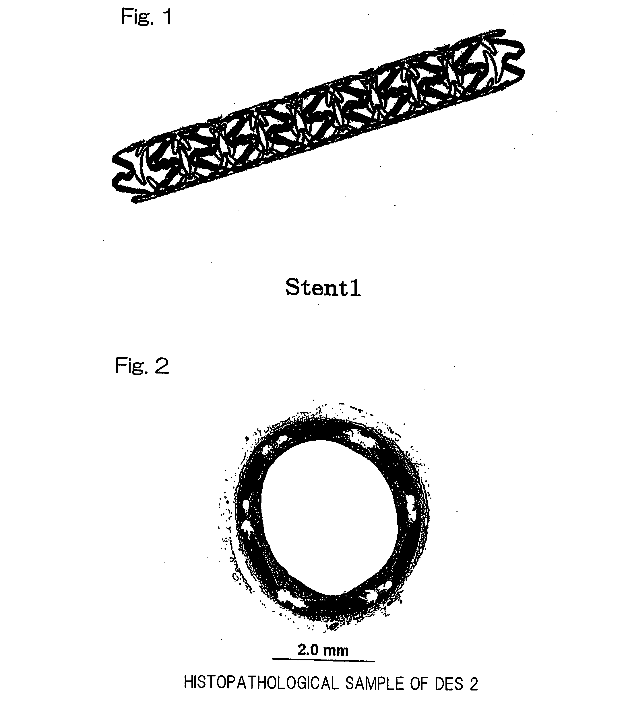 Sustained drug-releasing stent