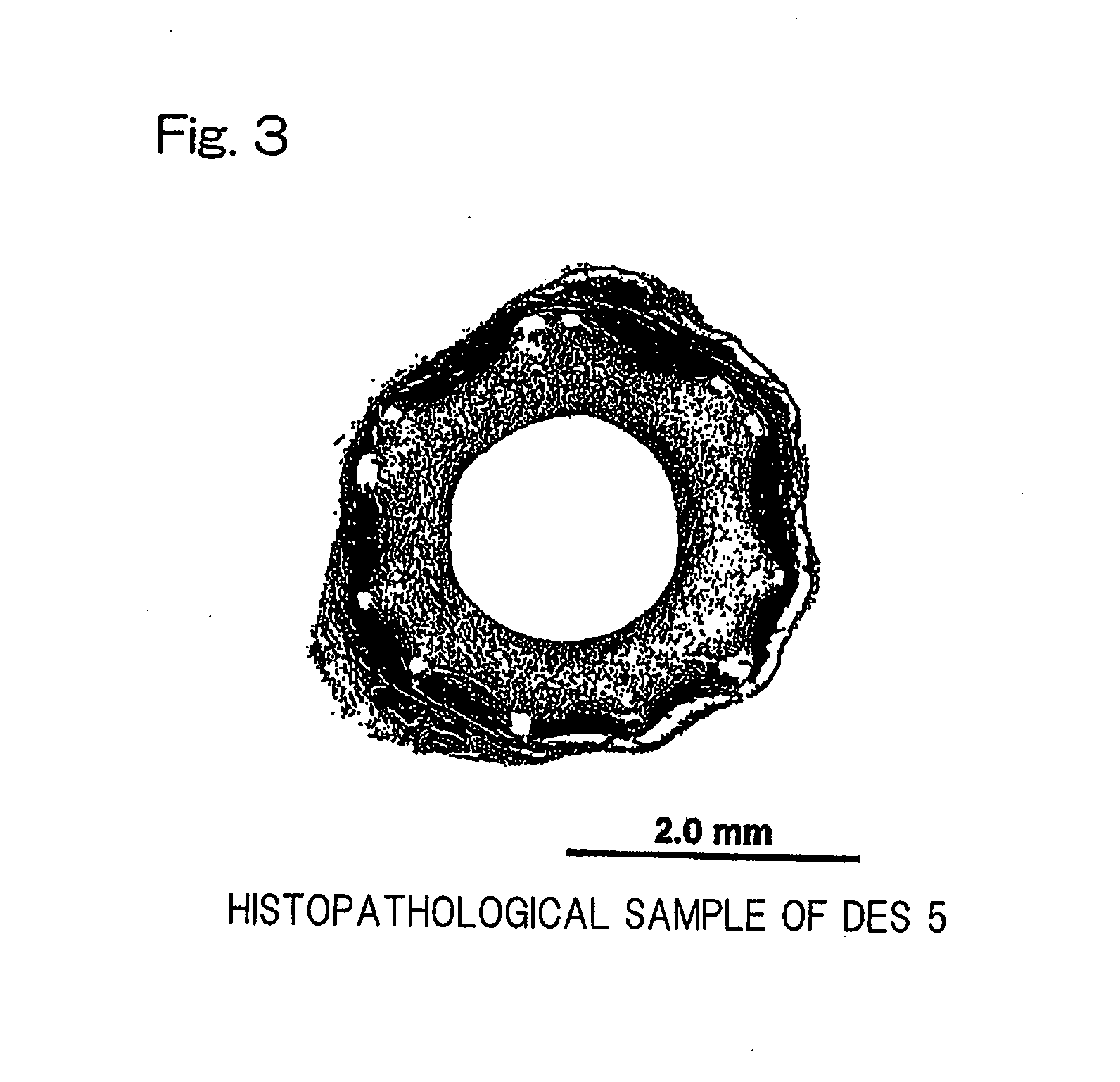 Sustained drug-releasing stent