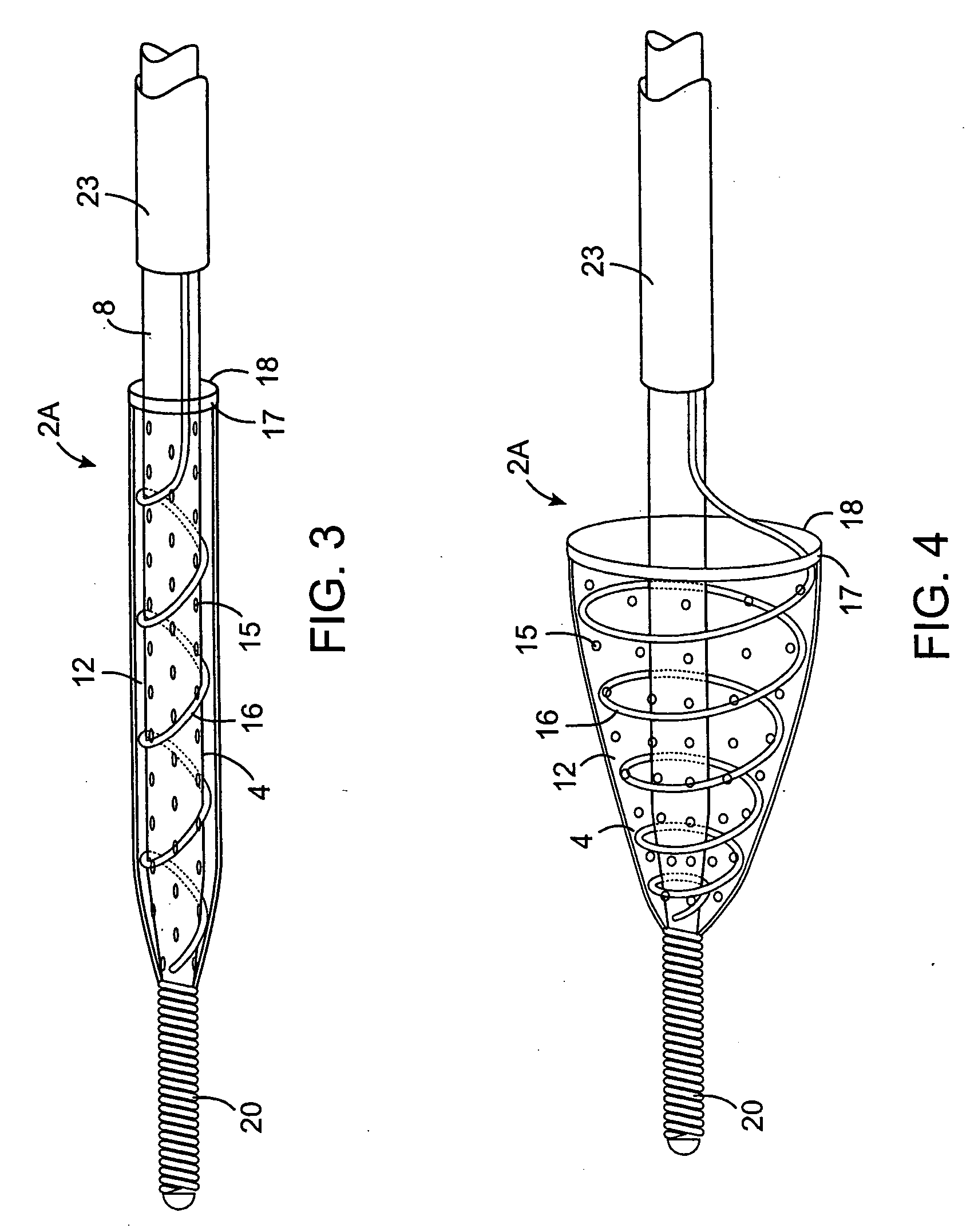 Methods and devices for filtering fluid flow through a body structure