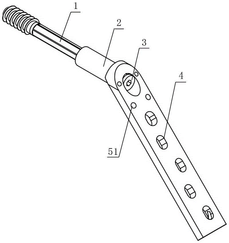 Dynamic hip device for femoral intertrochanteric fracture minimally invasive surgery