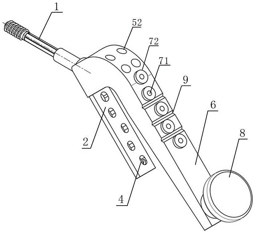 Dynamic hip device for femoral intertrochanteric fracture minimally invasive surgery