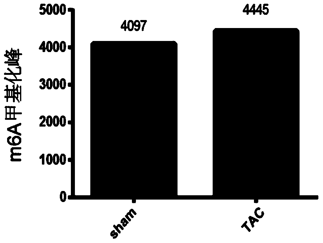 Application of FTO as target in treatment of pressure-loaded myocardial injury