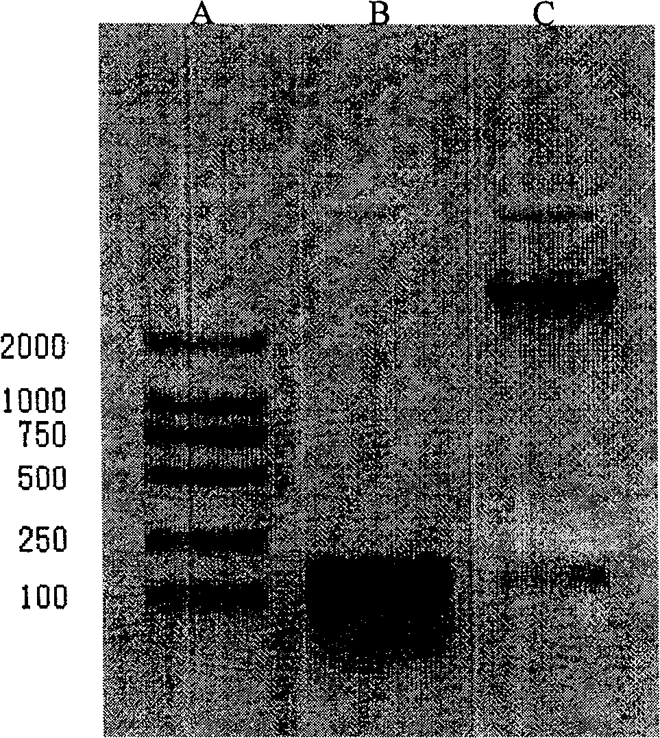 Gene of coding recombination buman natriurea and method of producing recombination human natriurea using the gene