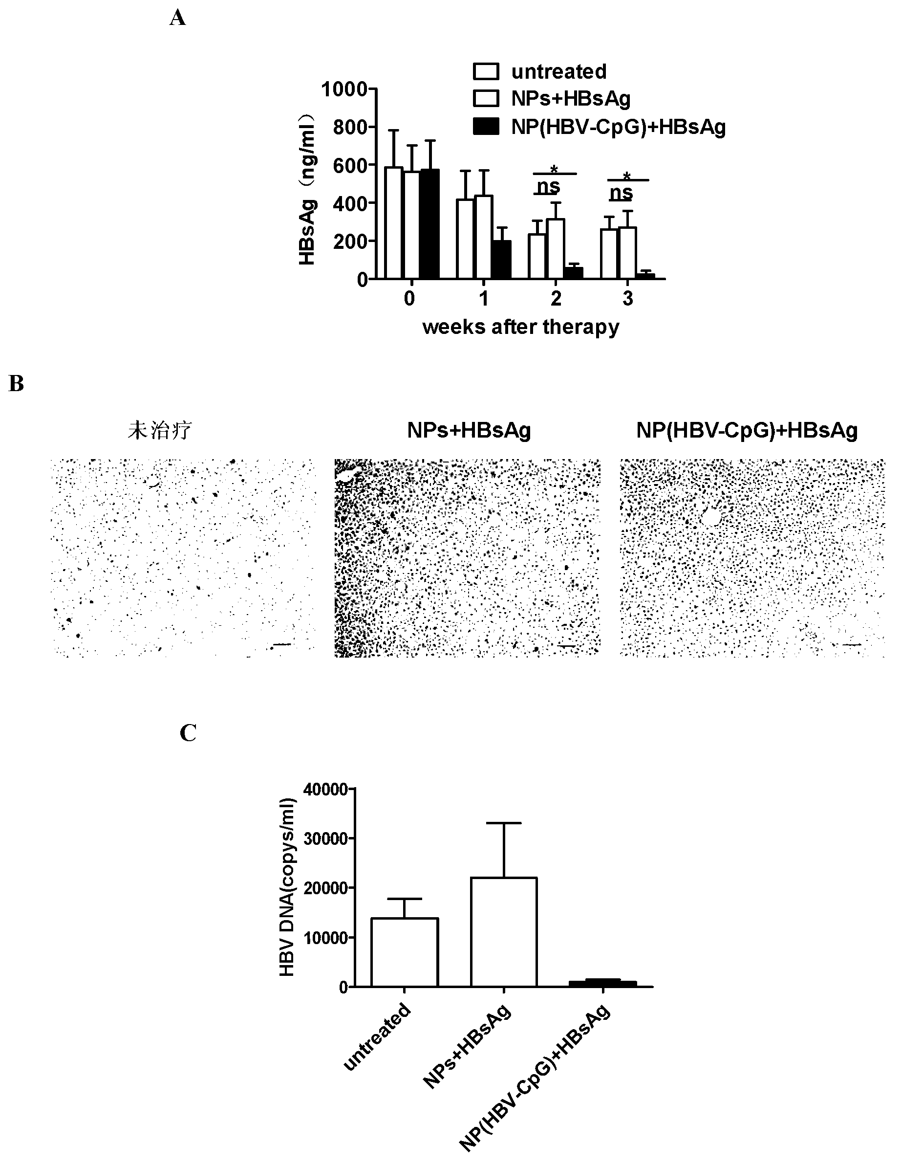 Application of PEG (polyethylene glycol)-PLA (Poly Lactic Acid) nano-material-coated HBV (Hepatitis B Virus)-CpG (Cytosine Phosphate Guanosine) in prevention and/or treatment of hepatitis B