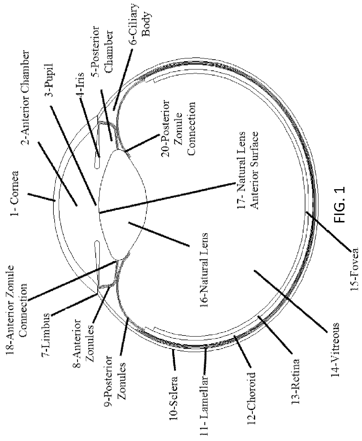 Accommodative intraocular lens that ejects post capsular opacification and self-centers