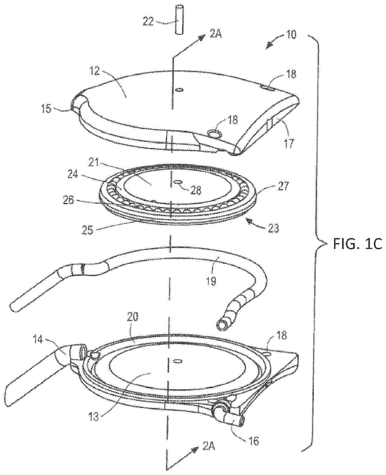 Apparatus and methods for treating excess intraocular fluid