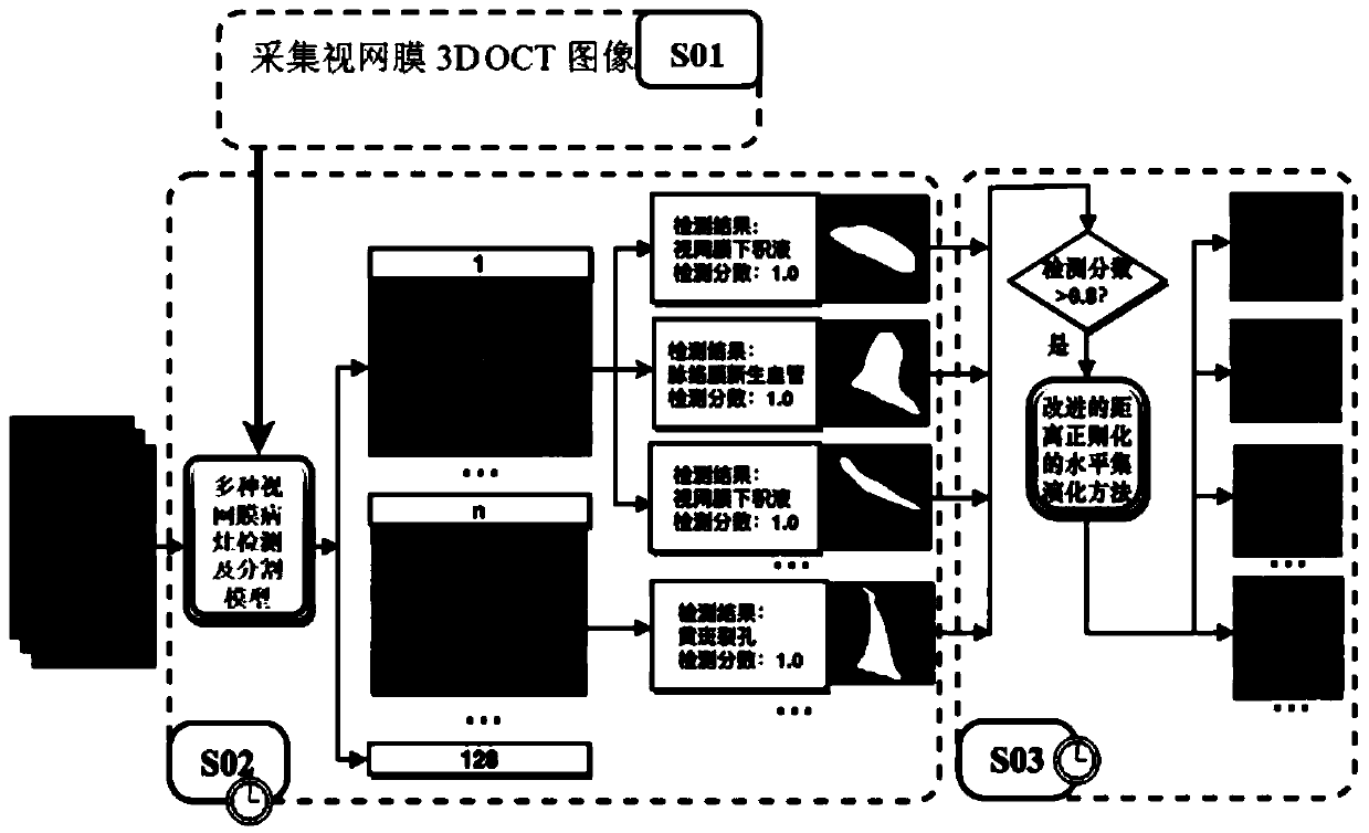 Automatic detection method for various retinal focuses in retinal OCT image