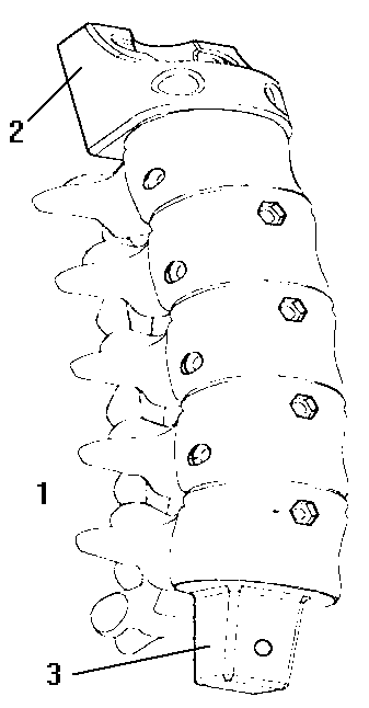 Spine simulation structural body for teaching