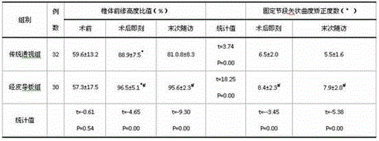 Disassembly type double-side type percutaneous individualized pedicle screw guiding template