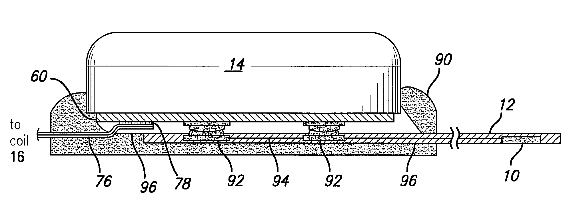 Cortical Implant System for Brain Stimulation and Recording