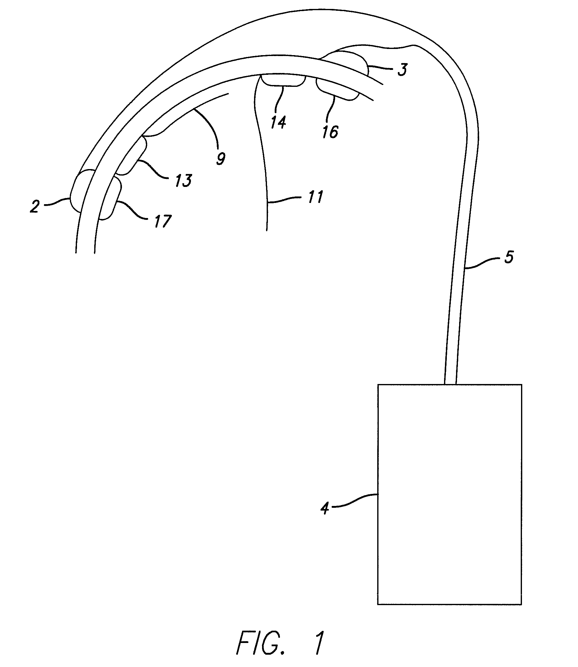 Cortical Implant System for Brain Stimulation and Recording