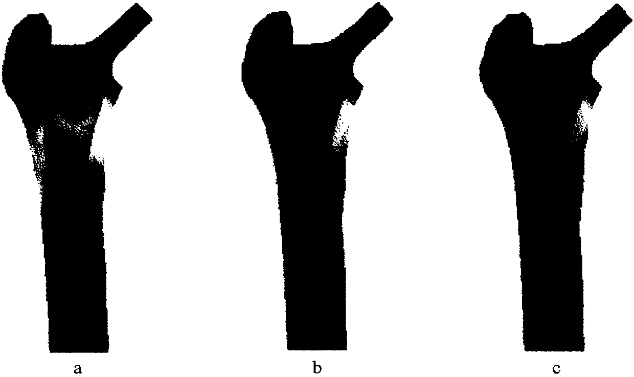 Variable-density porous metal orthopedic implant preparation method based on topology optimization technology