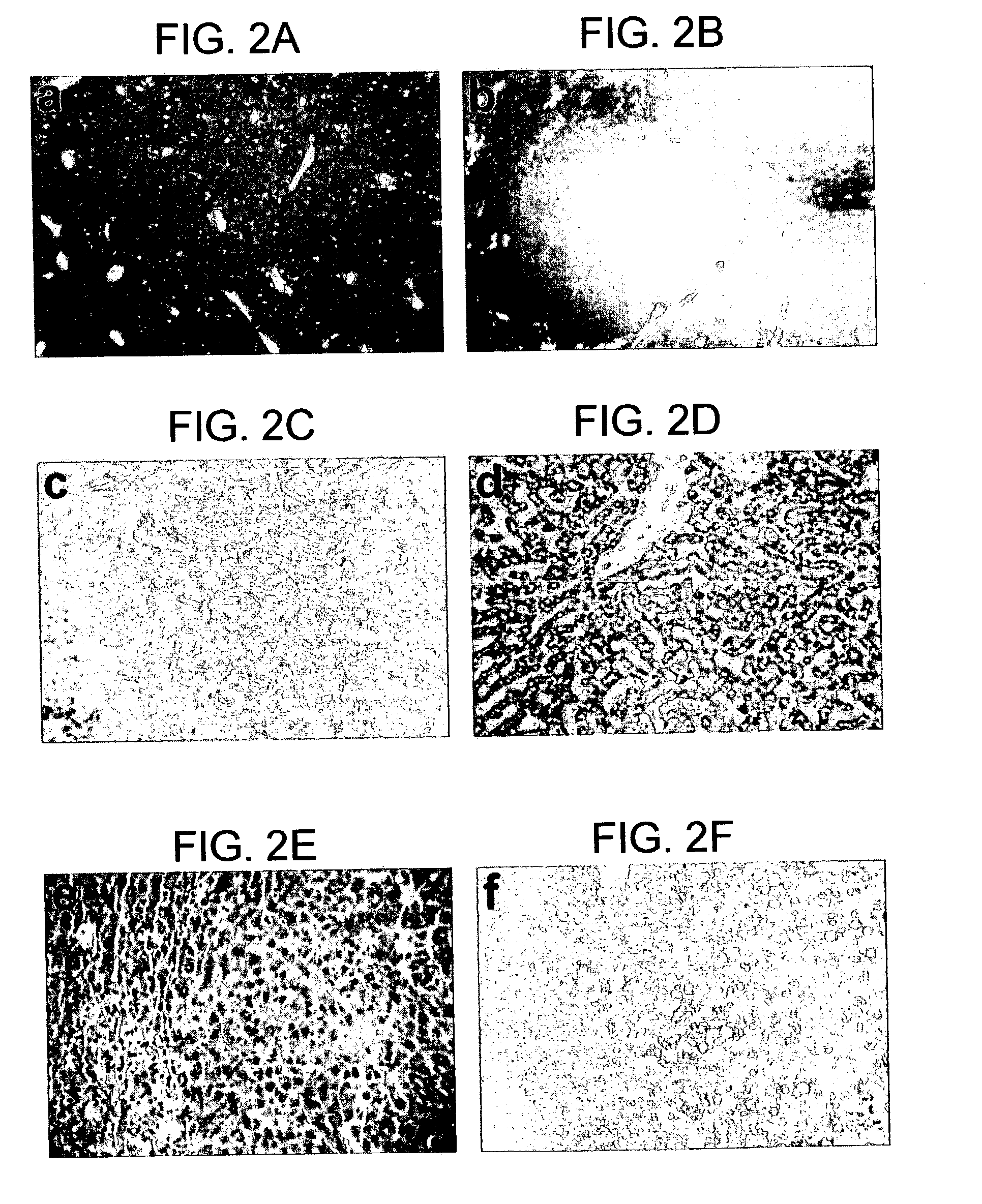 Animal model having a chimeric human liver