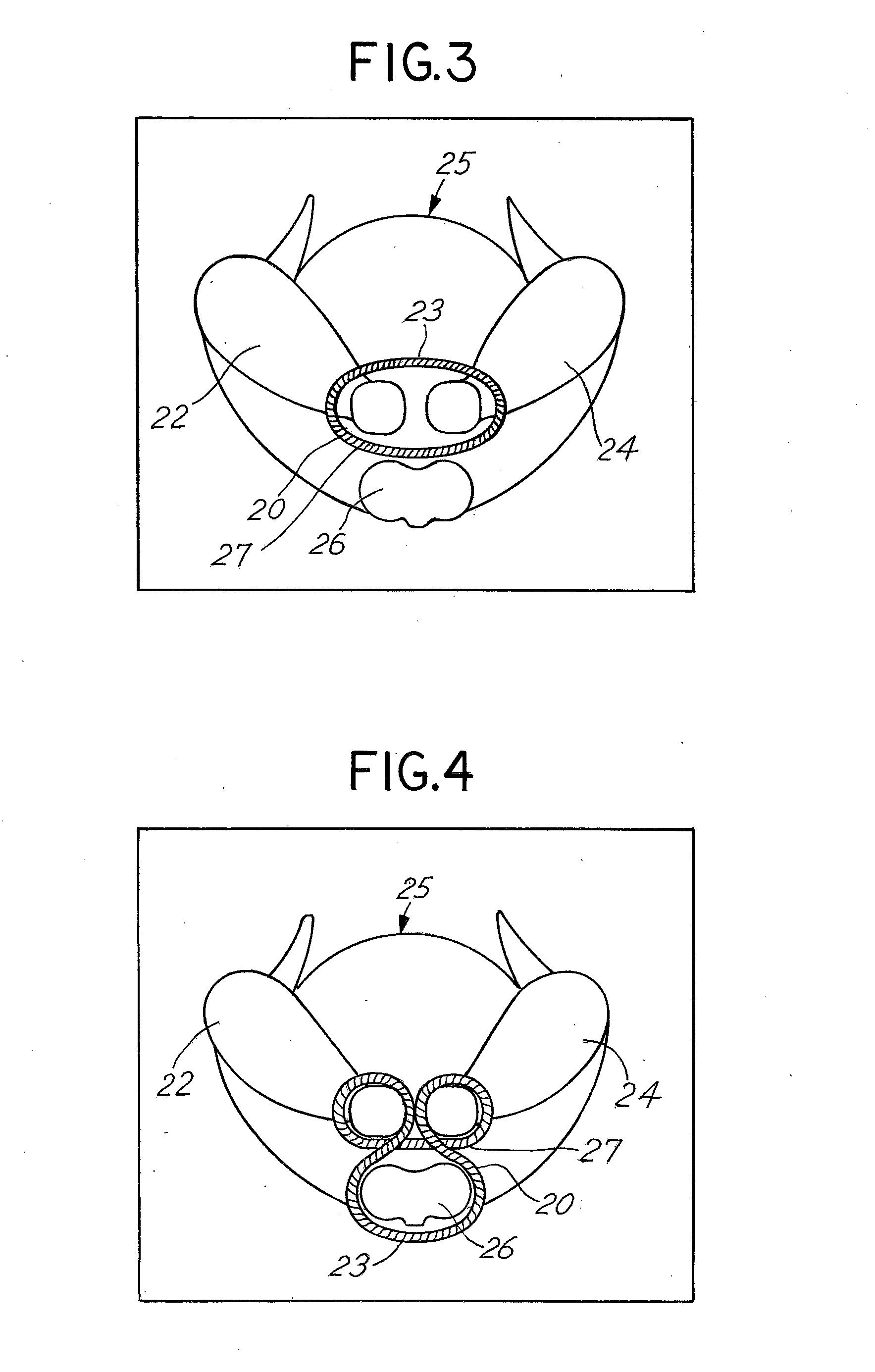 Elastic poultry binder construction and method of use for binding poultry