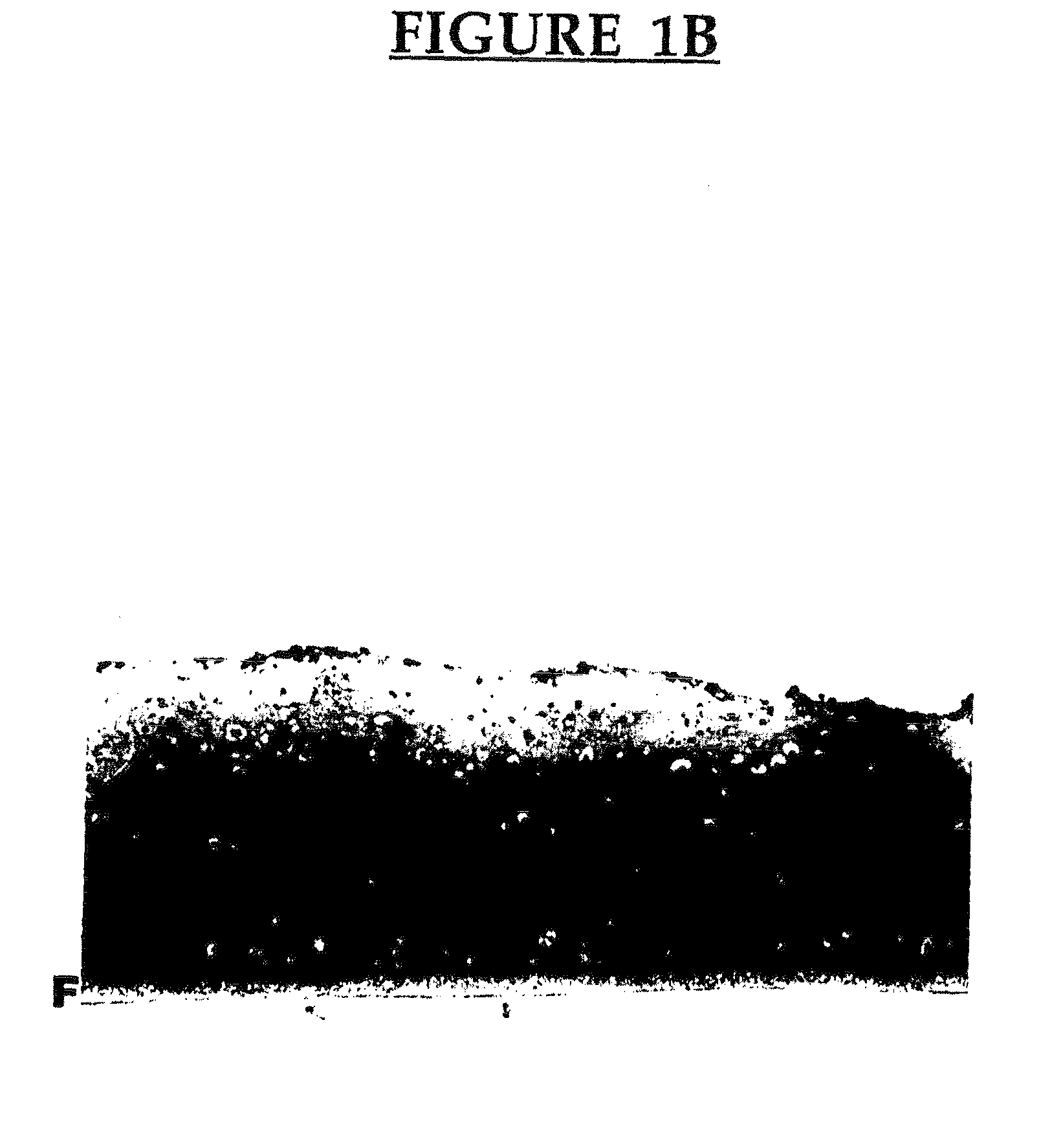 Reconstituted mineralized cartilage tissue