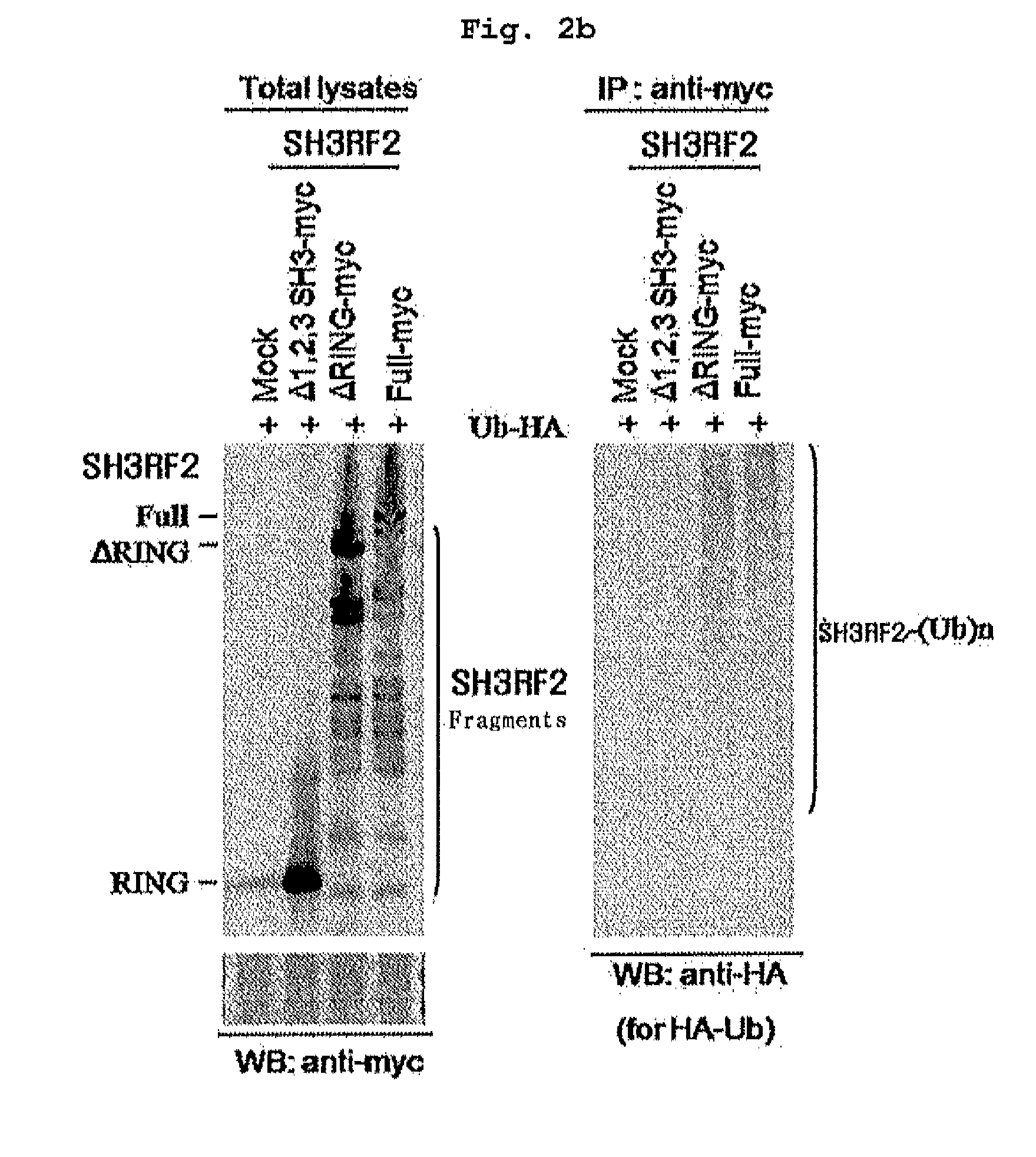 Composition containing inhibitors of the expression or activity of SH3RF2 for preventing or treating cancer