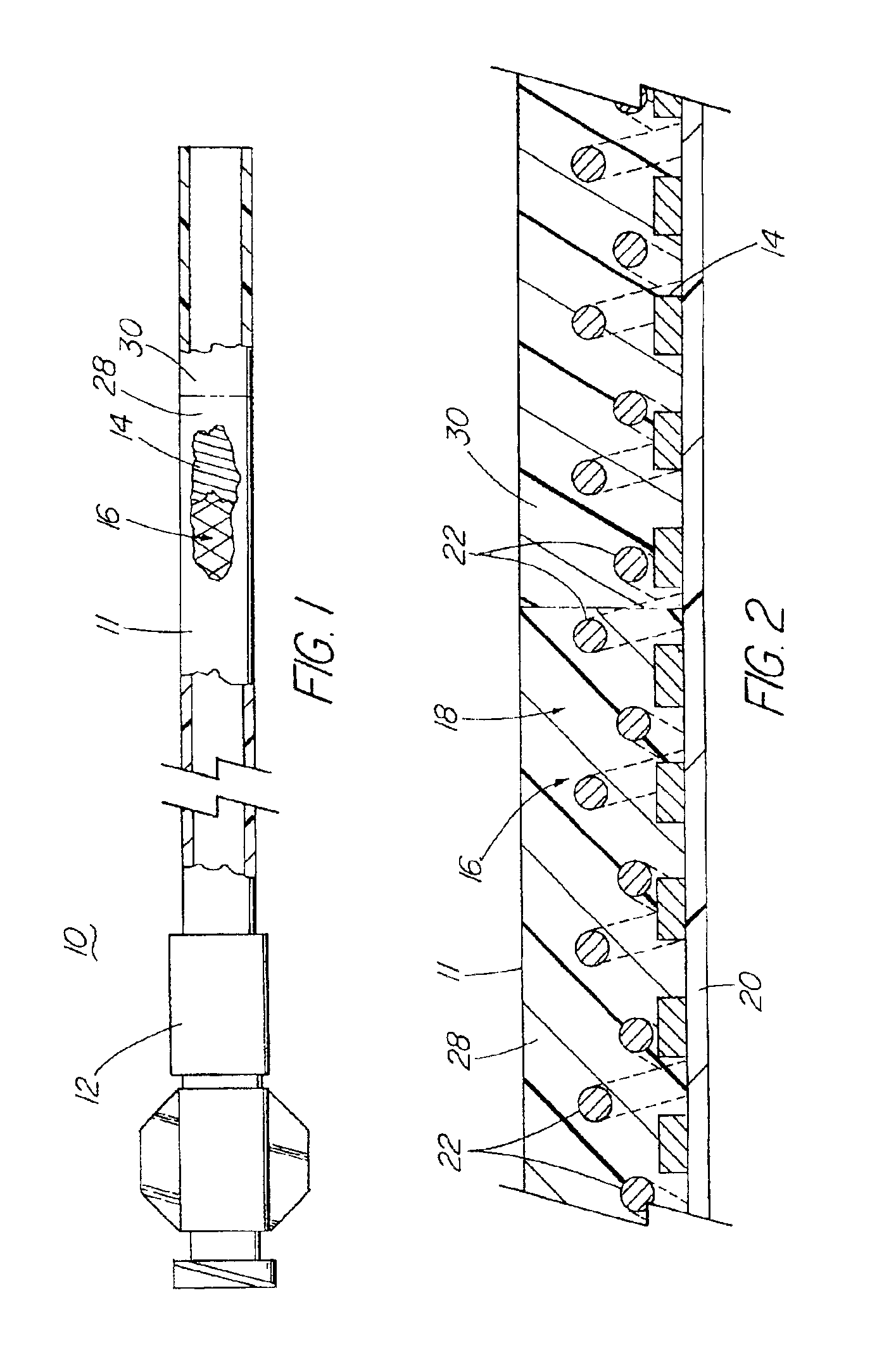 Medical device including tube having a braid and an expanded coil