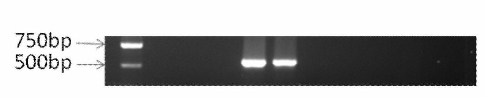 Detection primers and molecular detection method for pathogenic fungi of corn common rust