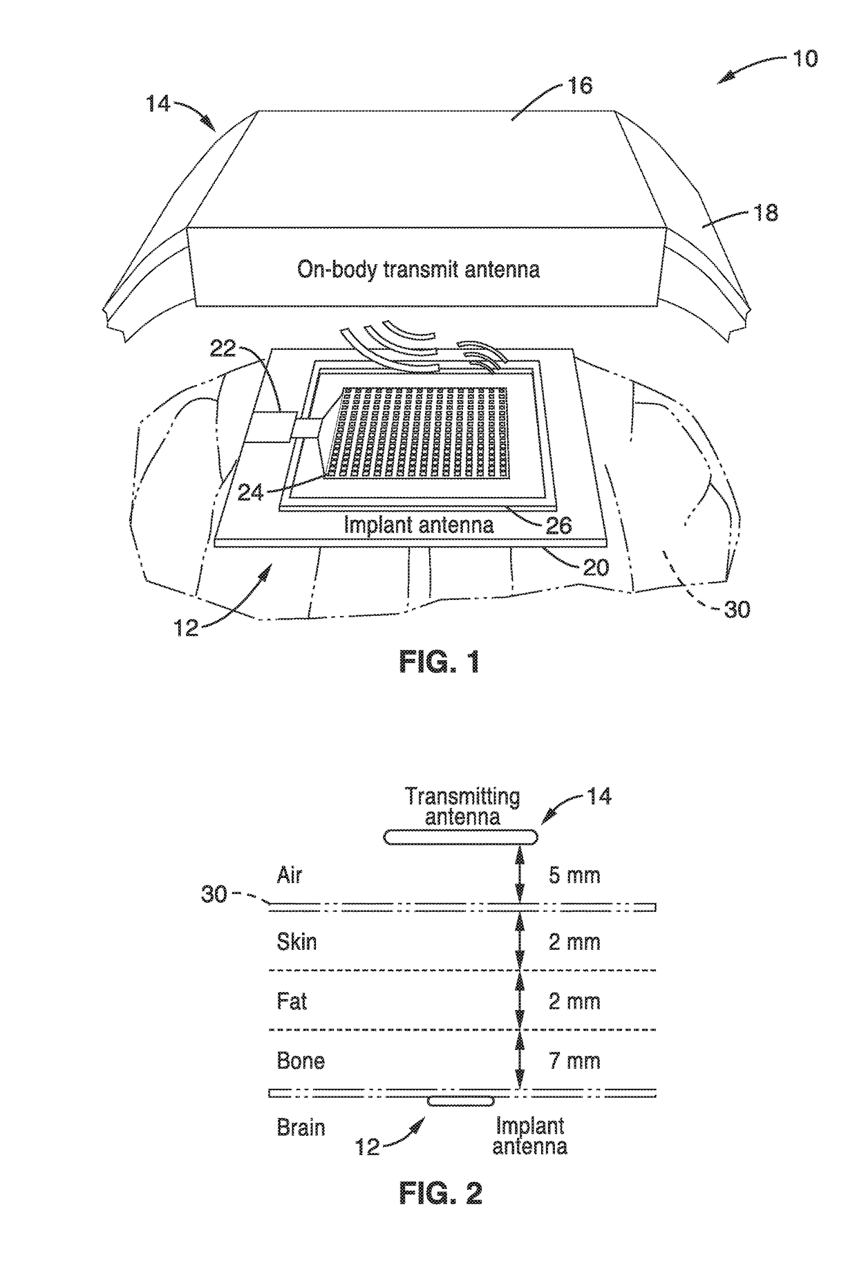 Monolithically integrated implantable flexible antenna for electrocorticography and related biotelemetry devices