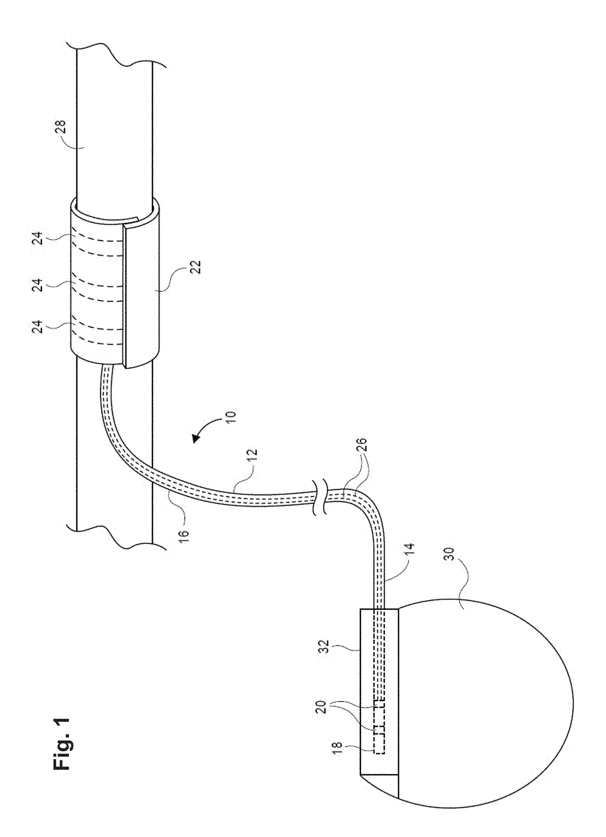 Nerve cuff electrodes fabricated using over-molded lcp