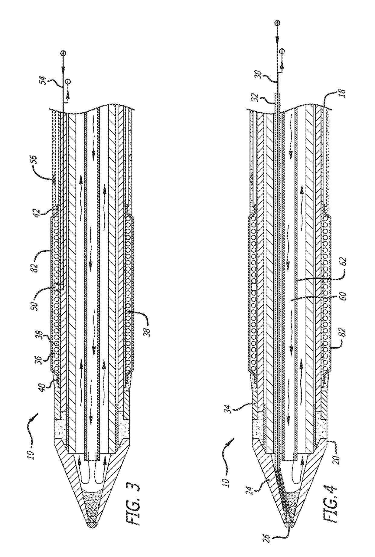 Spinal tissue ablation apparatus, system, and method