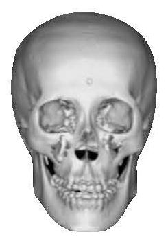 Computer aided design method for deciding orthodontic and orthognathic joint treatment operation opportunity