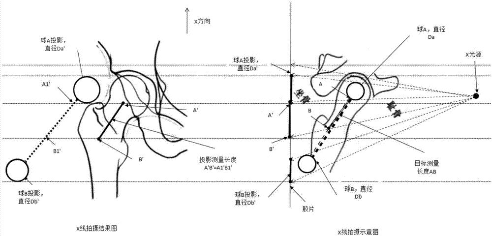 An X-ray image digital measurement and correction device and method