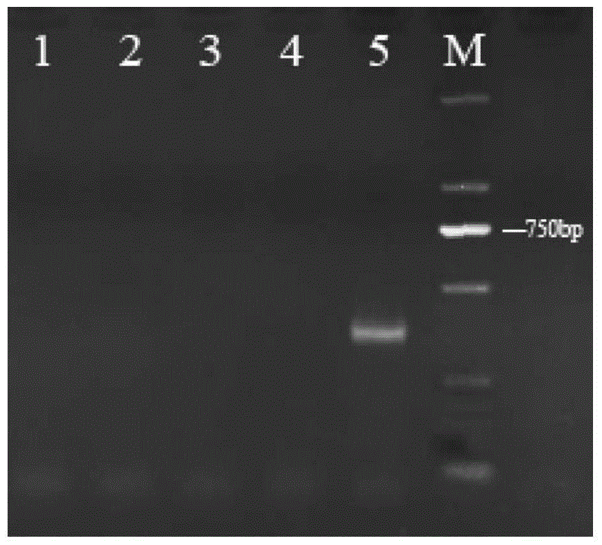 Characteristic nucleotide sequence, nucleic acid molecular probe, kit and method for identifying branched Cordyceps