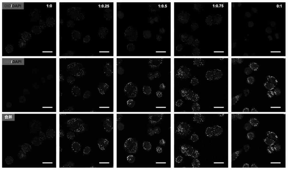 Neutrophil-like nano drug delivery system as well as preparation method and application thereof