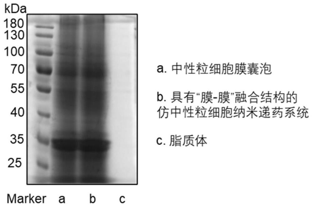 Neutrophil-like nano drug delivery system as well as preparation method and application thereof