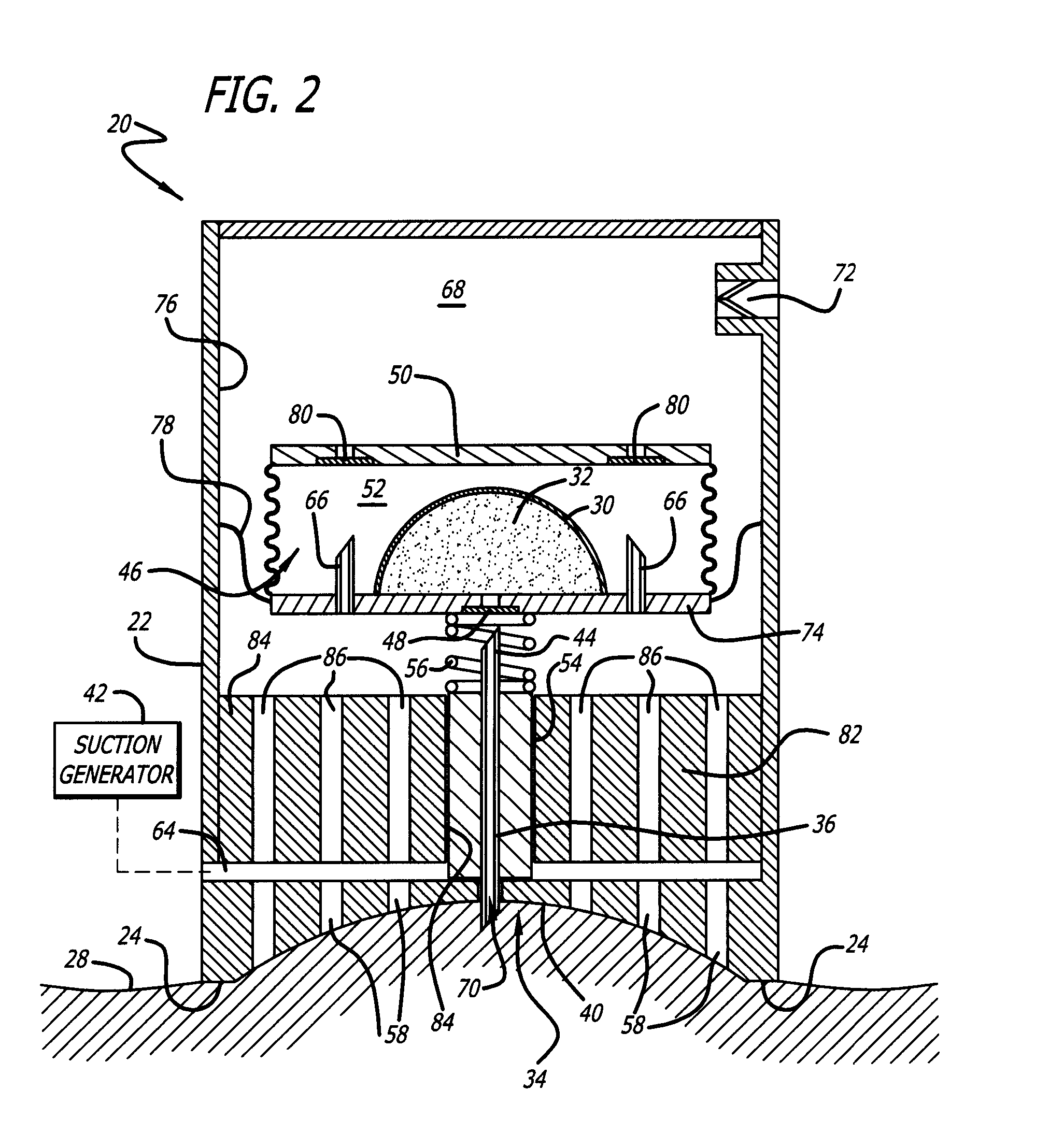 Ablation and micro-needles