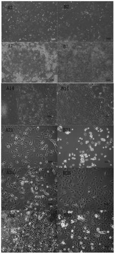 Culture medium and method for inducing directional differentiation of embryonic stem cells into keratinocytes