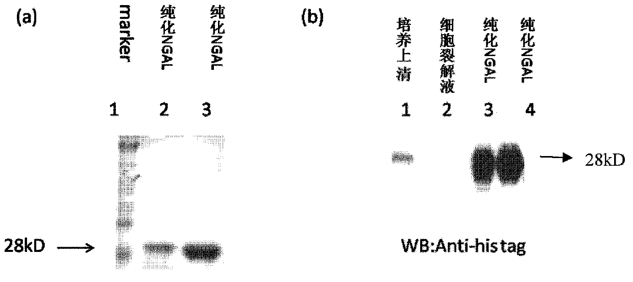 Anti-human neutrophil gelatinase-associated lipocalin antibodies and use thereof