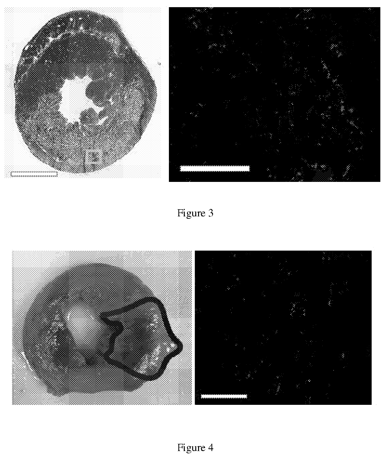 Soluble Extracellular Matrix Composition and Method for Intravascular Delivery