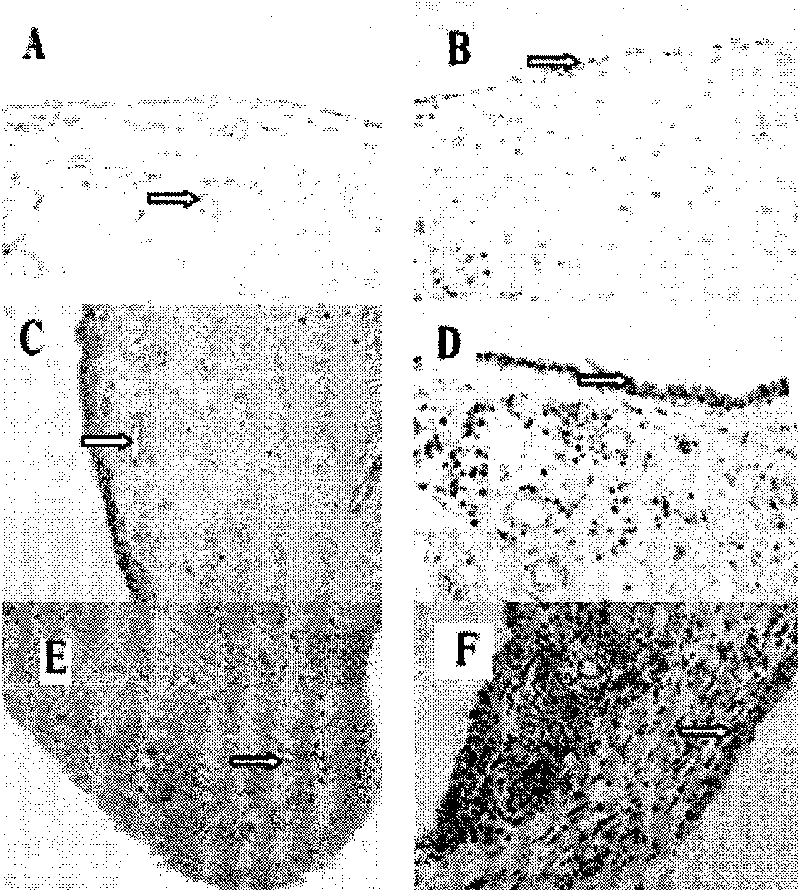 Pharmaceutical application of CYR61 protein