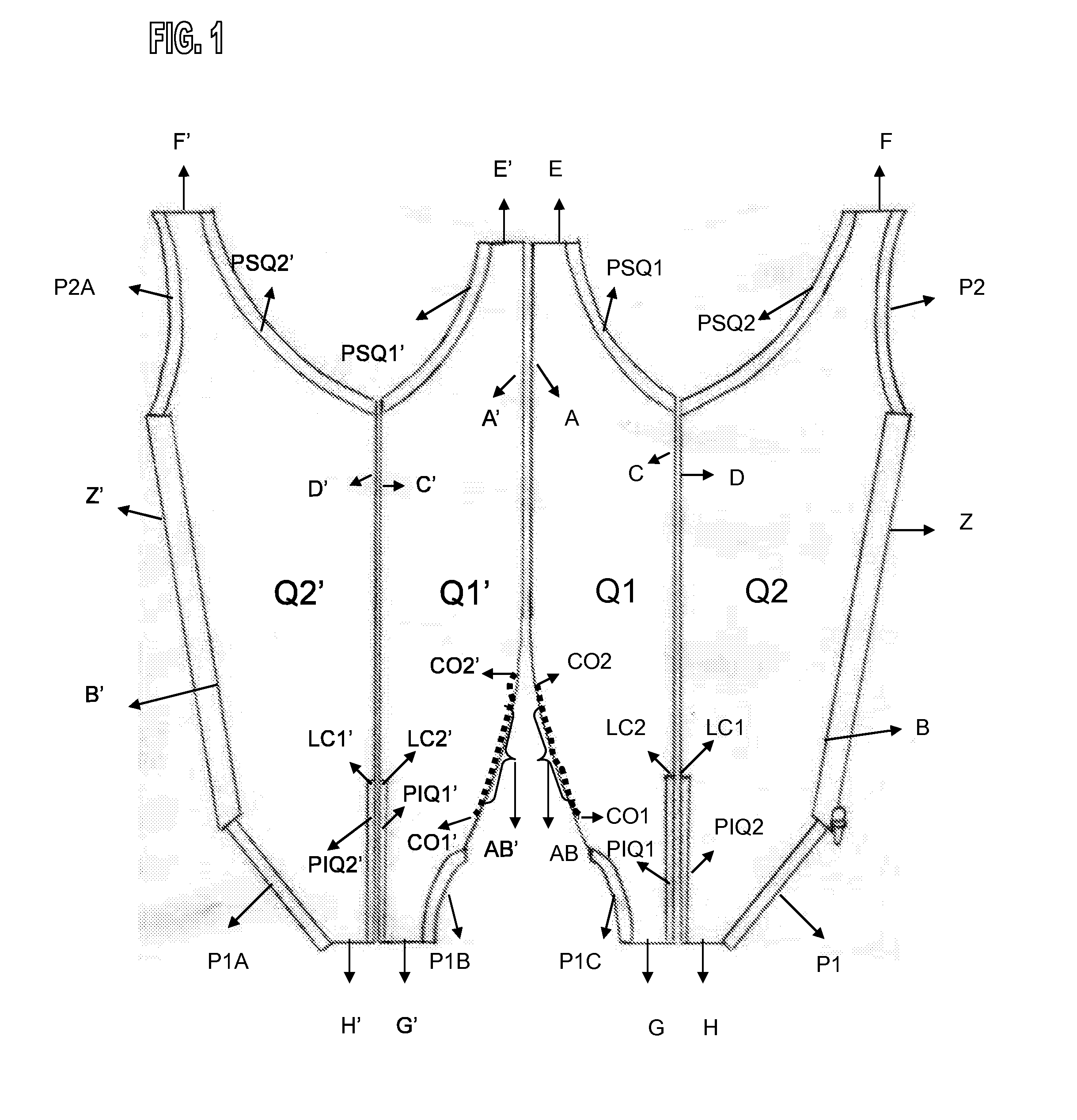 Structural arrangement for post-surgery garment for domestic animals and the like