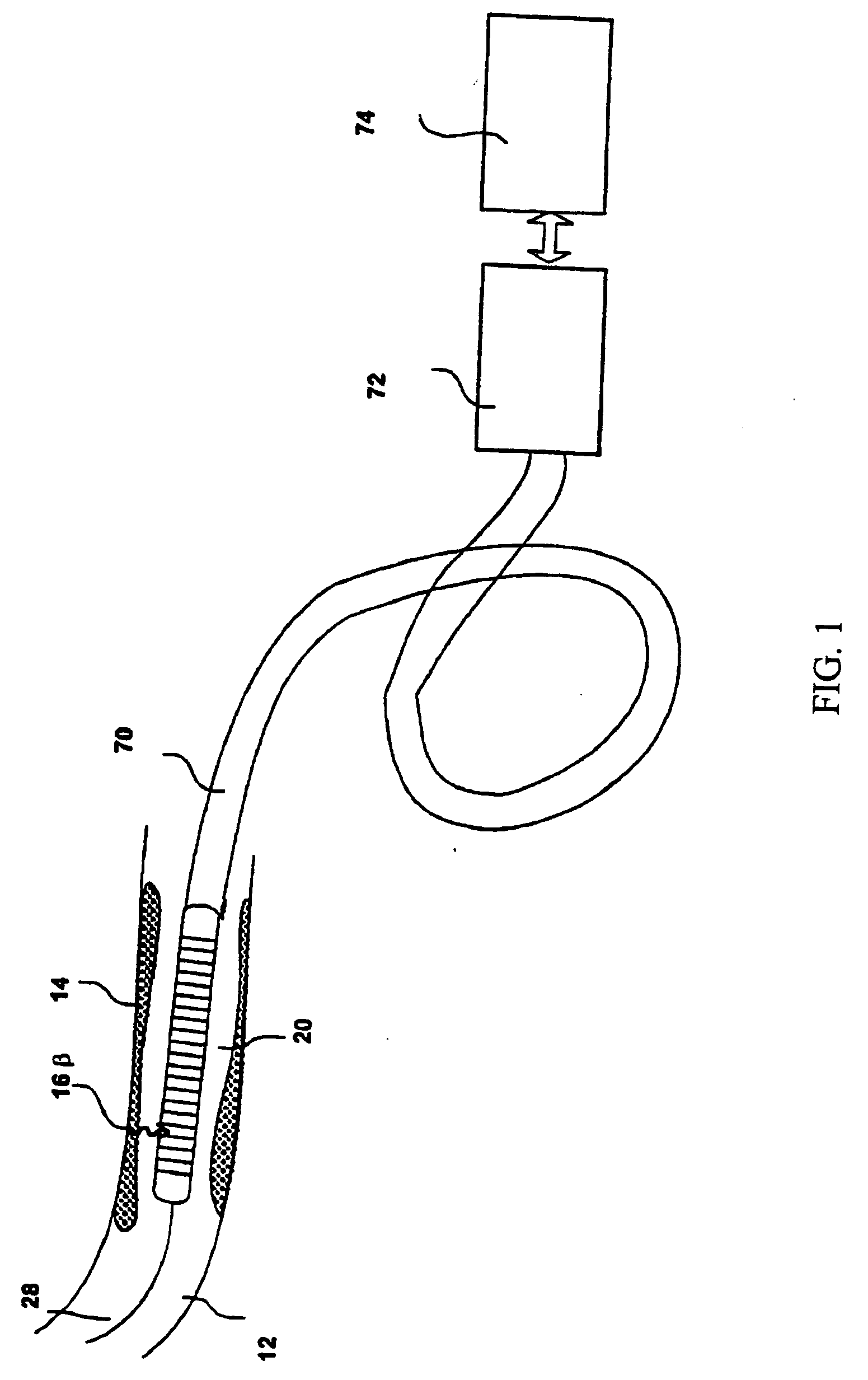 Intravascular imaging detector