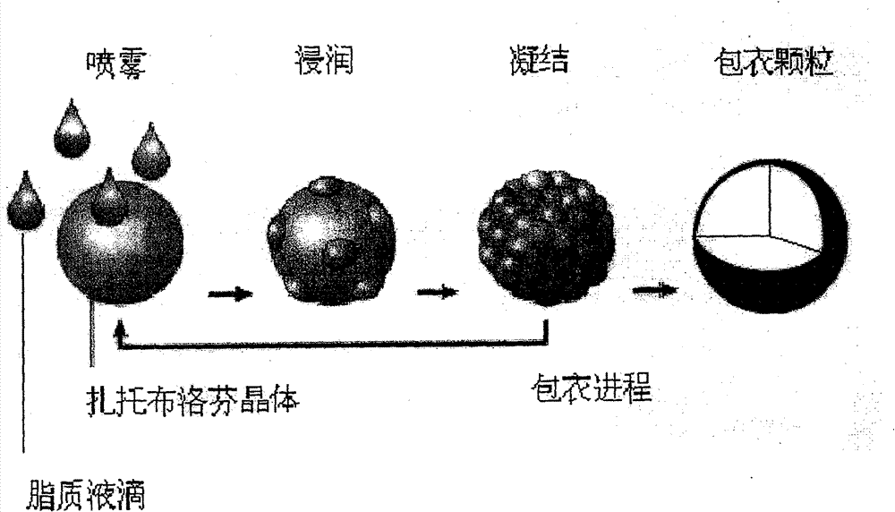 Enteric sustained-release preparation containing zaltoprofen and preparation method thereof