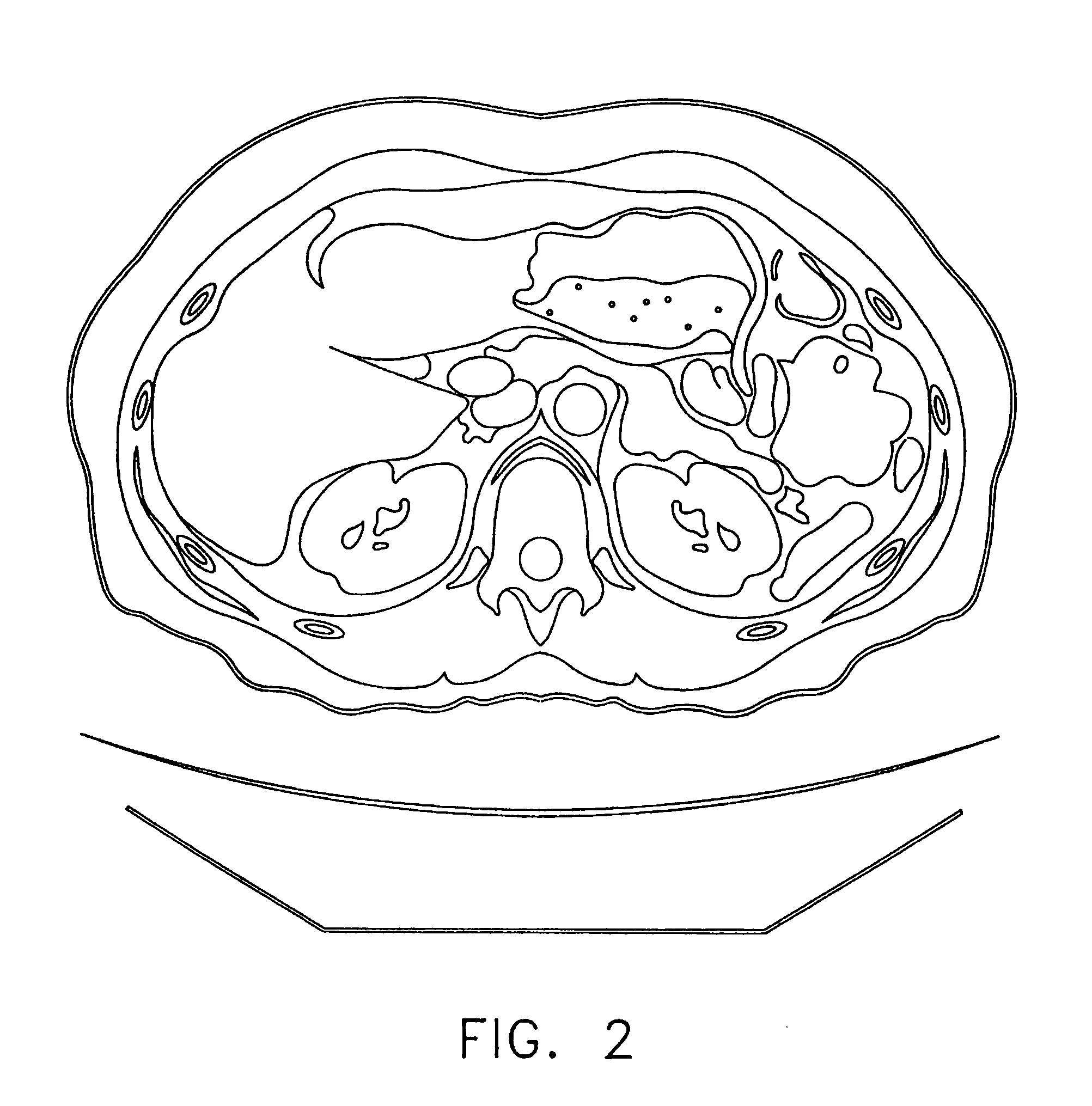 Anatomical visualization and measurement system