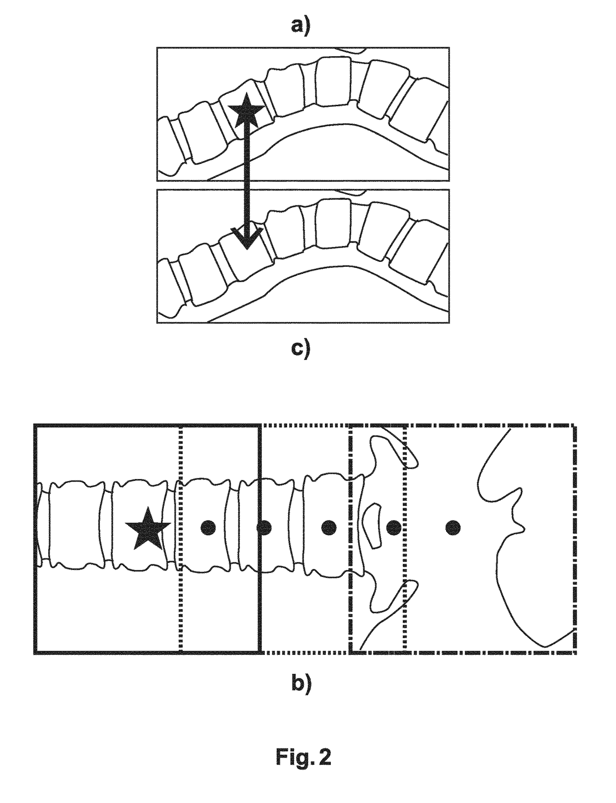 Imaging system for a vertebral level