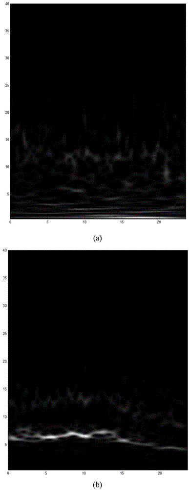 Epileptic feature extraction and automatic identification method based on electroencephalogram signal