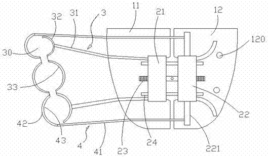 Implant anchorage combined single-side arch expansion device